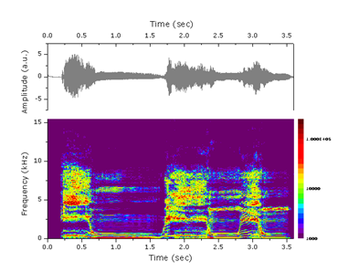 STFTwithTimeSeries.png